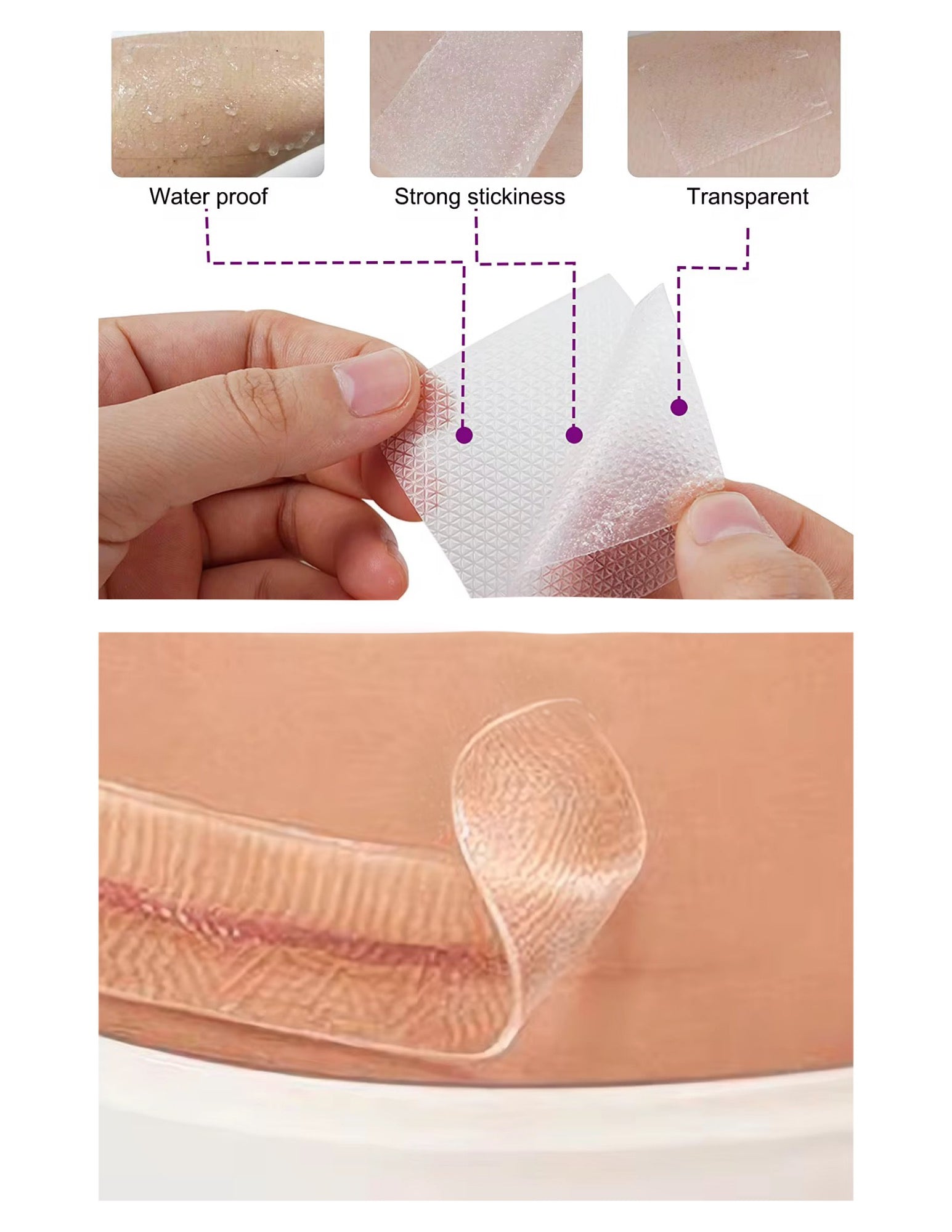 C-Section Silicone Scar Sheets