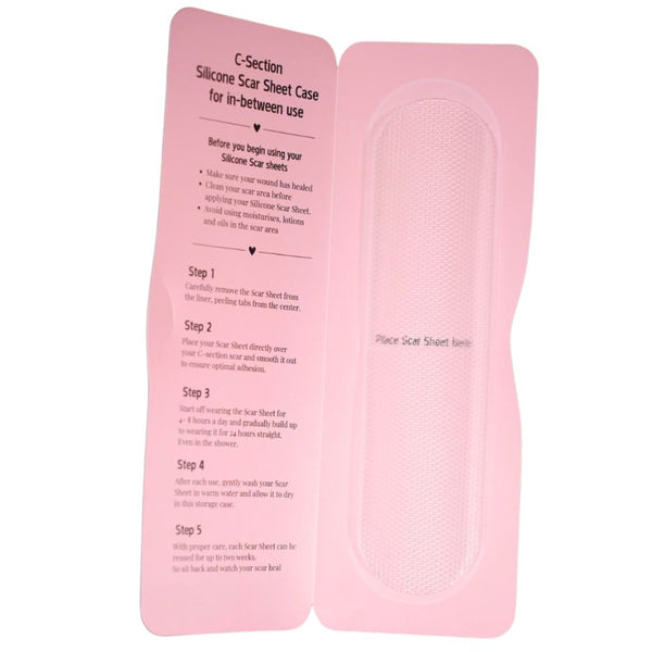 C-Section Silicone Scar Sheets